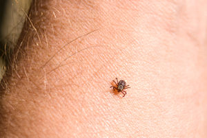 Tick crawling on a human arm
