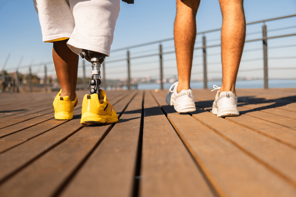 Two people walking on a boardwalk one with a prosthetic leg